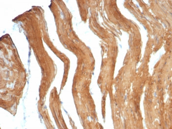SMMHC Antibody / Smooth Muscle Myosin Heavy Chain