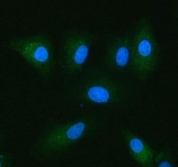 NADK2 Antibody / C5orf33