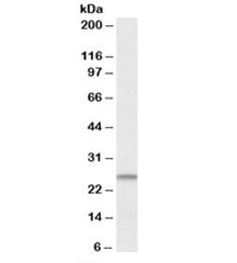 Western blot testing of human heart lysate with CHCHD3 antibody at 1ug/ml. Predicted molecular weigh