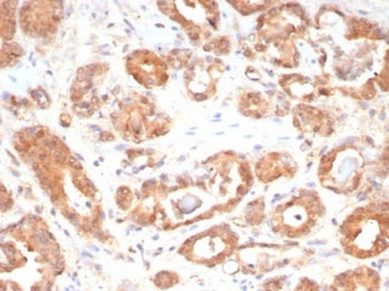 IHC staining of FFPE human prostate tissue with Macrophage migration inhibitory factor antibody (clo