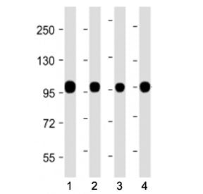 Western blot testing of Calnexin antibody at 1:2000: Lane 1) human PANC-1, 2) mouse brain, 3) mouse 