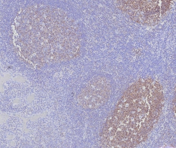 IHC staining of FFPE human tonsil tissue with BOB1 antibody (clone BOB1/7469). HIER: boil tissue sec