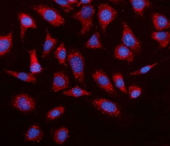 Elovl4 Antibody