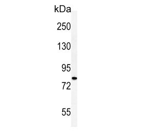 Western blot testing of human HepG2 cell lysate with Cadherin 20 antibody. Predicted molecular weigh