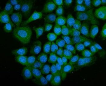 SGT1 Antibody / ECD