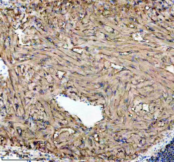 IHC staining of FFPE zebrafish heart tissue with Zebrafish Gls antibody. HIER: boil tissue sections 