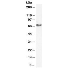 Western blot testing of human KELLY cell lysate (neuroblastoma line) with NEFL antibody at 1ug/ml. P