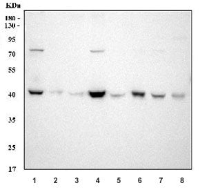 Western blot testing of 1) human Hela, 2) human K562, 3) human Jurkat, 4) human Caco-2, 5) rat brain
