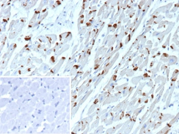 IHC staining of FFPE human heart tissue with Cadherin 2 antibody (clone CDH2/9491). Inset: PBS used 