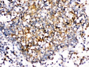 IHC testing of FFPE human tonsil with CD153 antibody. HIER: Boil the paraffin sections in pH 6, 10mM