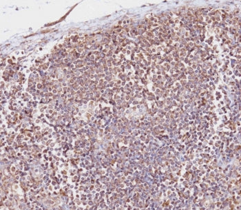 IHC staining of FFPE human lymph node tissue with CD163L1 antibody. HIER: boil tissue sections in pH