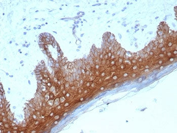 IHC staining of FFPE human skin tissue with Desmoglein 1 antibody (clone DSG1/8576R). HIER: boil tis