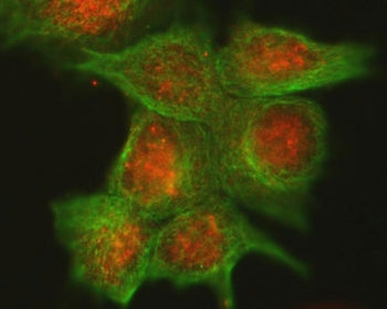 Immunofluorescent staining of FFPE human MCF7 cells with Cdk4 antibody (red) and Alpha Tubulin mAb (