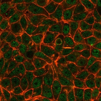 Immunofluorescent staining of PFA-fixed MCF7 cells using TIF1 alpha antibody (green, clone PCRP-TRIM