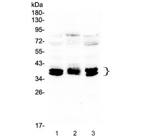 Western blot testing of human 1) HEK293, 2) PC-3 and 3) HeLa lysate with CXCR4 antibody at 0.5ug/ml.