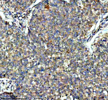 IHC analysis of KCNA6 using anti-KCNA6 antibody. KCNA6 was detected in a paraffin-embedded section o