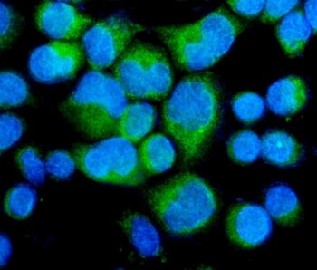 Immunofluorescent staining of FFPE human SiHa cells with Myosin Phosphatase antibody (green) and DAP