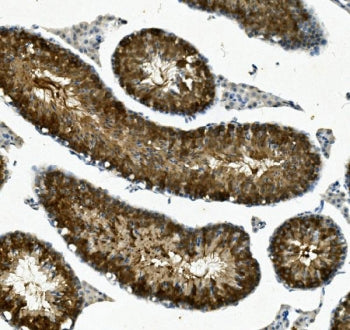 IHC staining of FFPE mouse testis with IFT88 antibody. HIER: boil tissue sections in pH8 EDTA for 20