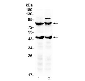 Thyroid Stimulating Hormone Receptor / TSHR Antibody (beta chain)