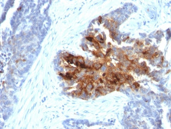 IHC staining of human ovary with recombinant TAG-72 antibody (clone CA72/2869R). HIER: boil tissue s