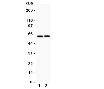 Western blot testing of LTBR antibody and Lane 1: HeLa; 2: A549; Observed size: 45~60KD depending on