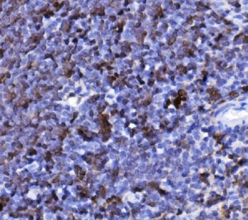 IHC staining of FFPE mouse spleen tissue with Cd20 antibody. HIER: boil tissue sections in pH8 EDTA 