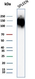 Western blot testing of human spleen tissue lysate with CD45 antibody (clone rPTPRC/1147). Expected 