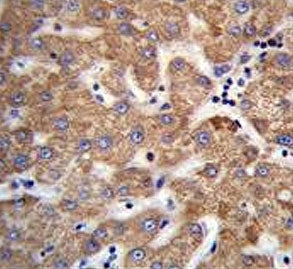 IHC testing of FFPE human liver tissue with SOWAHD antibody. HIER: steam section in pH6 citrate buff