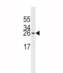 EIF4E Antibody