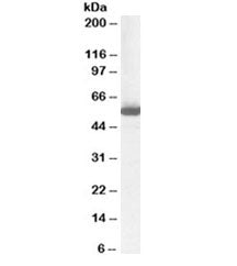 Western blot testing of human liver lysate with ALDH1 antibody at 1ug/ml. Predicted molecular weight