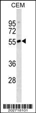 IGHD Antibody