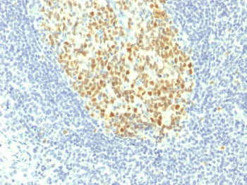 IHC testing of FFPE human tonsil with MCM7 antibody (clone MCM7/1467). Required HIER: boil tissue se