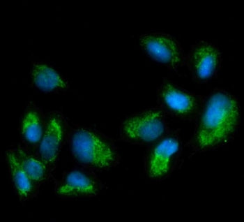 Monoamine Oxidase A Antibody / MAOA