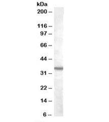 Western blot testing of K562 lysate with BDKRB1 antibody at 2ug/ml. Predicted molecular weight: ~40k