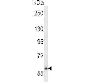 Western blot testing of human NCI-H292 cell lysate with TEC antibody. Expected molecular weight: 58-