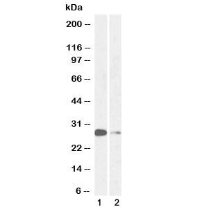 Western blot testing of 1) mouse lung and 2) rat lung lysate with MASH1 antibody at 1ug/ml. Predicte