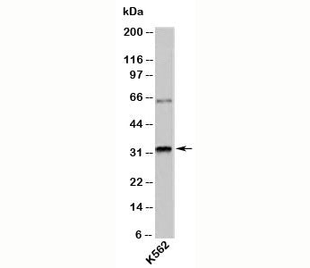 Western blot testing of human samples with RAX antibody at 1ug/ml.
