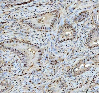PSMA1 Antibody / Proteasome 20S alpha 1