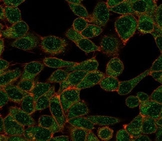 CHRAC17 Antibody / POLE3
