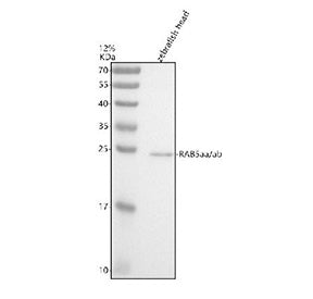 Western blot analysis of Rab5aa/ab protein using Zebrafish RAB5aa/ab antibody and zebrafish head tis