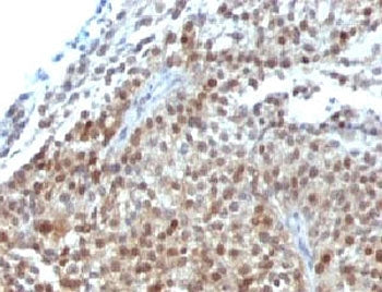 p21 Antibody Cocktail / CDKN1A