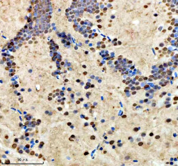 IHC staining of FFPE zebrafish brain tissue with Zebrafish Hmgb2 antibody, HRP secondary and DAB sub