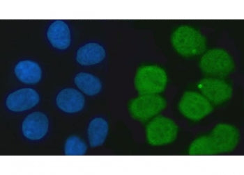 KHSRP Antibody / FUBP2