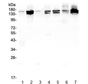 Western blot testing of human 1) placenta, 2) HeLa, 3) U-2 OS, 4) PC-3, 5) Caco-2, 6) A549 and 7) K5