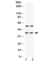 Western blot testing of human 1) HeLa and 2) MCF7 cell lysate with TREX2 antibody at 0.5ug/ml. Predi