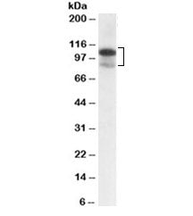 Western blot testing of MOLT4 lysate with SATB1 antibody at 0.3ug/ml. Predicted molecular weight ~86