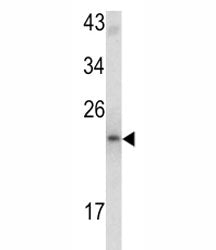 MCT-1 Antibody
