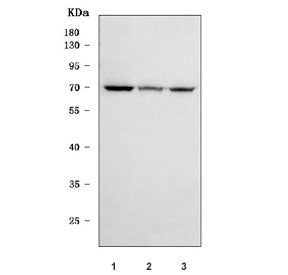 SGSH Antibody / N-sulphoglucosamine sulphohydrolase / HSS