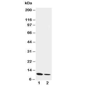 Western blot testing of Resistin antibody and Lane 1: recombinant mouse protein 10ng; 2: 5ng