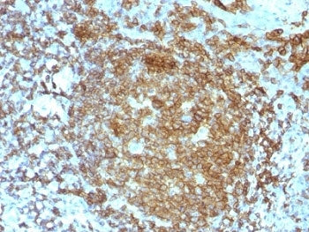 CD45RA Antibody (Leukocyte marker)